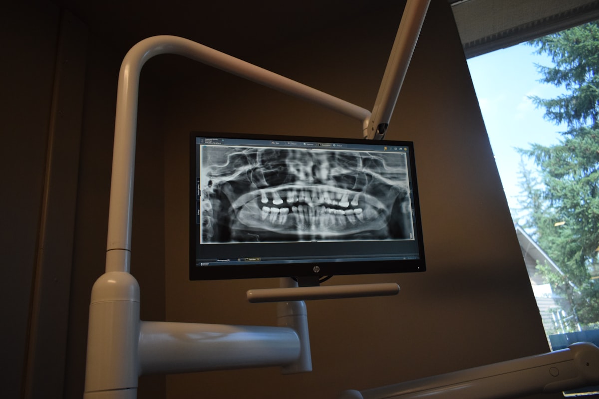 A dental x-ray displayed on a monitor in a clinic